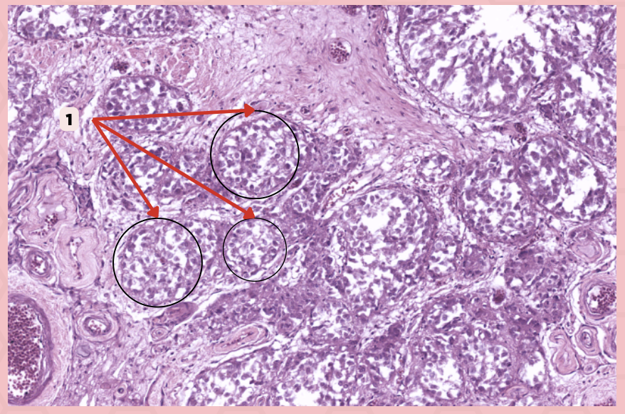 <p>Identify the structure labeled as 1.</p>