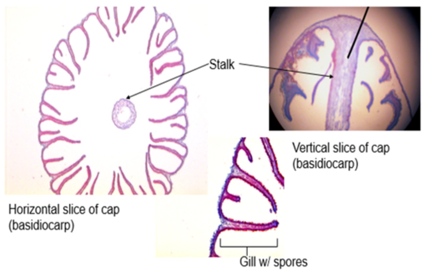 <p>basidiomycota</p>