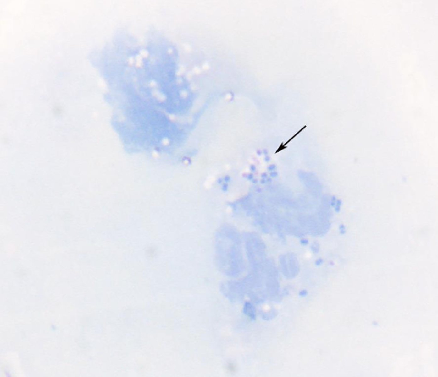 <p>What has caused the appearance of this slide?</p>