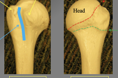 <p>What are the arts of the Proximal humerous anteriorly and posteriorly</p>