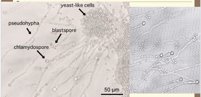 <p>C. albicans structures</p>