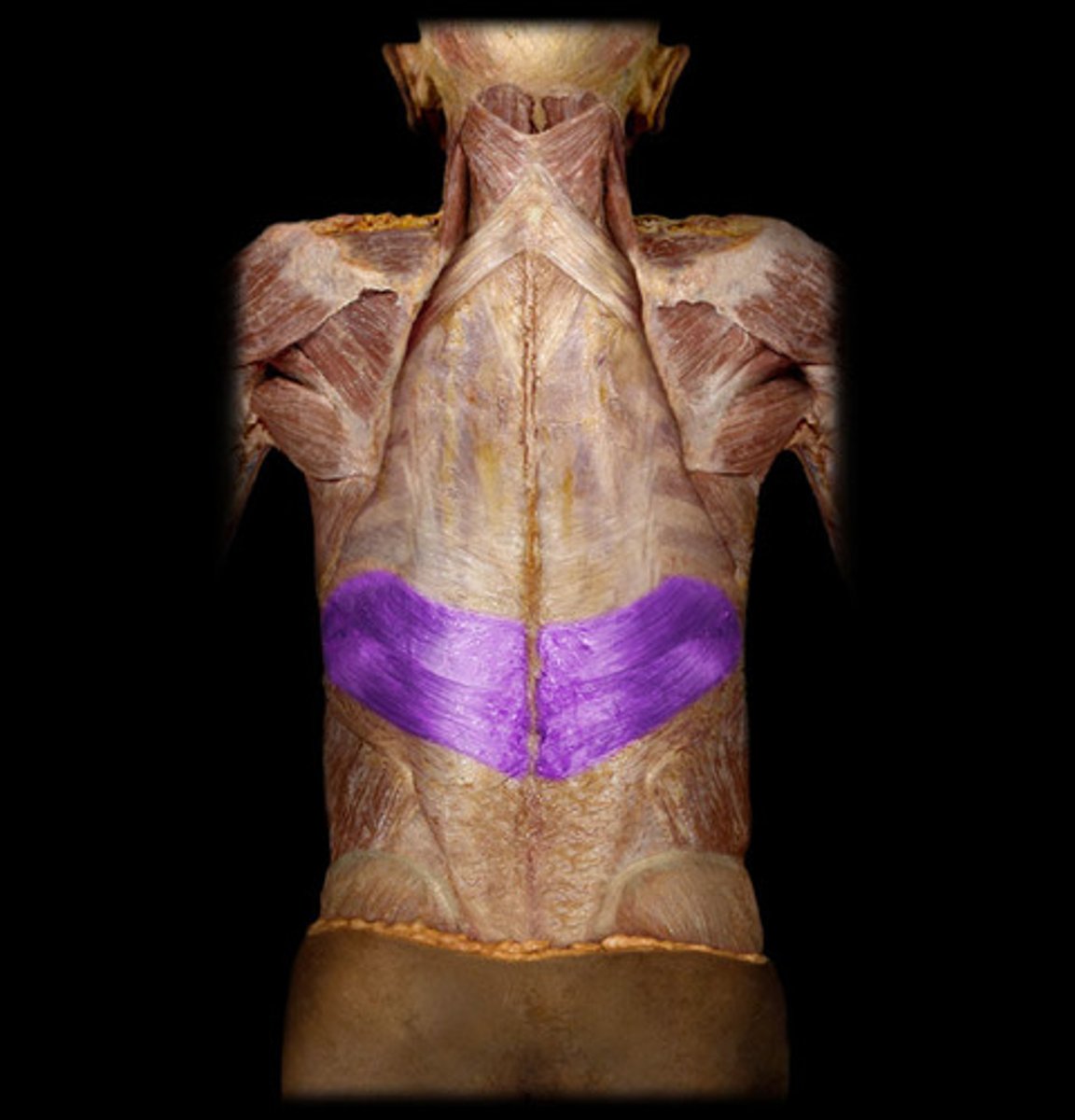 <p>origin: spinous processes of T11-L2</p><p>insertion: ribs 8-12</p><p>action: assists with exhalation</p>