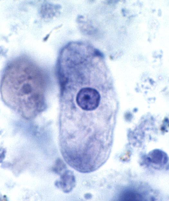 <p>Identify the organism based on the trophozoite form</p>