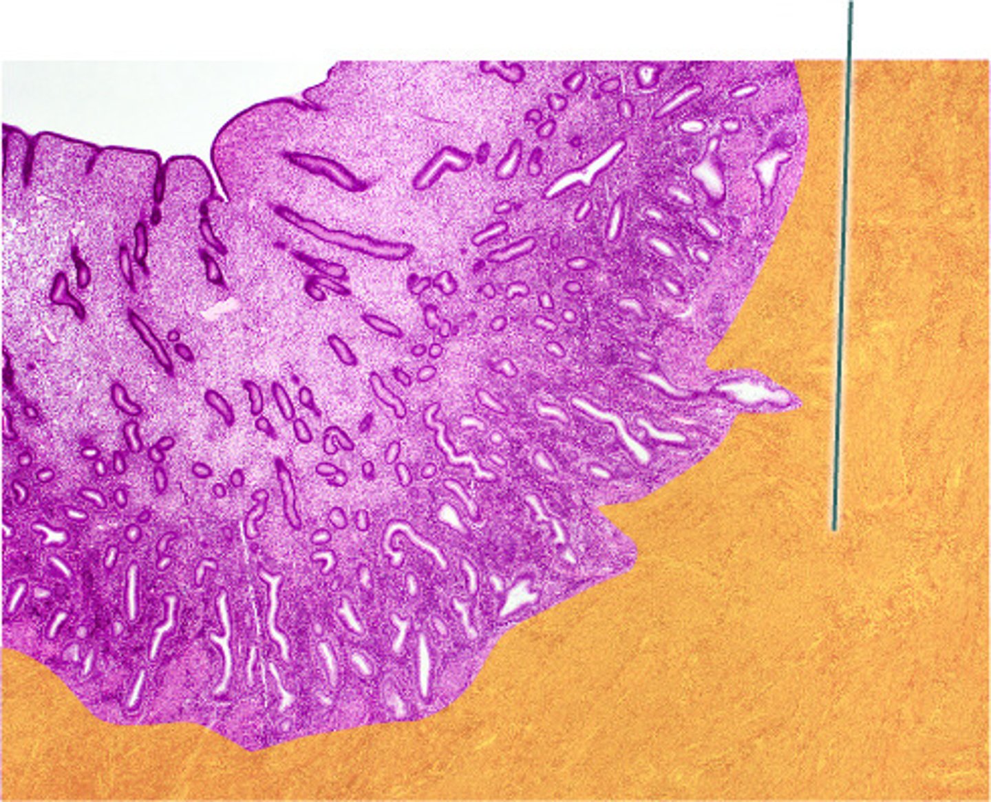 <p>myometrium</p>