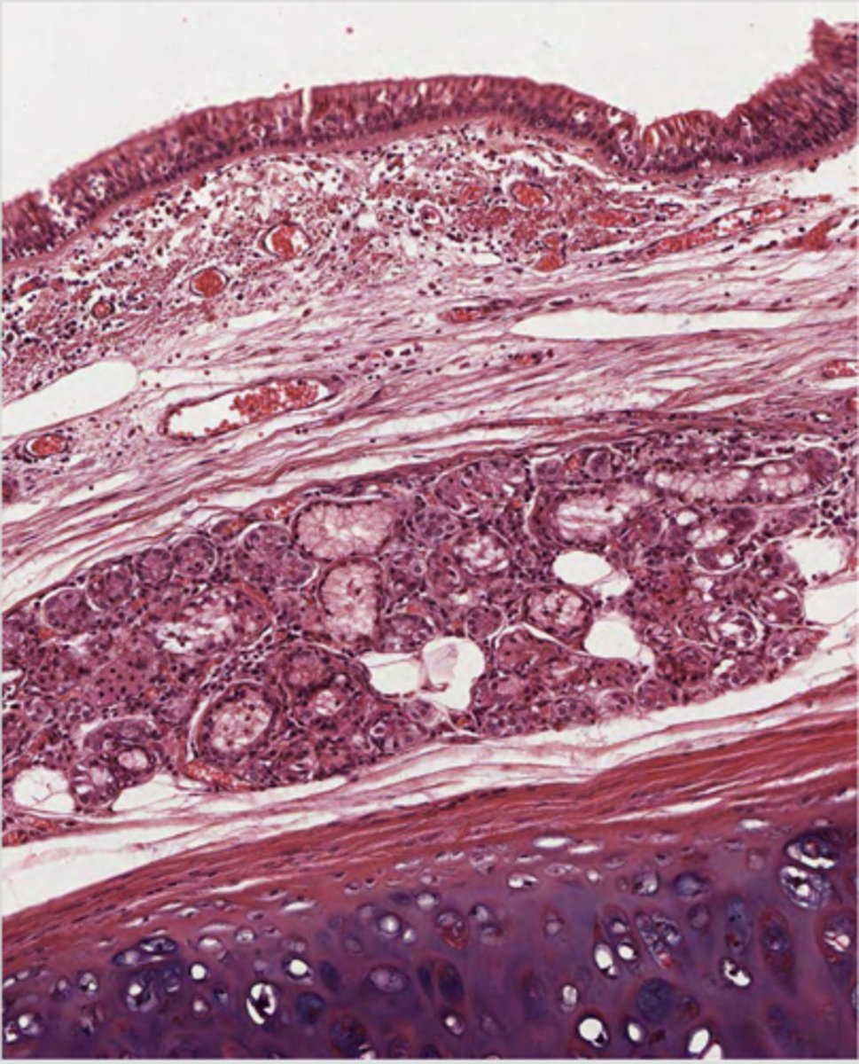 <p>ID the region of this epithelium?</p>