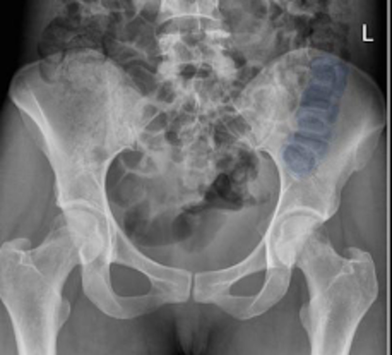 <p>What is outlined?</p>