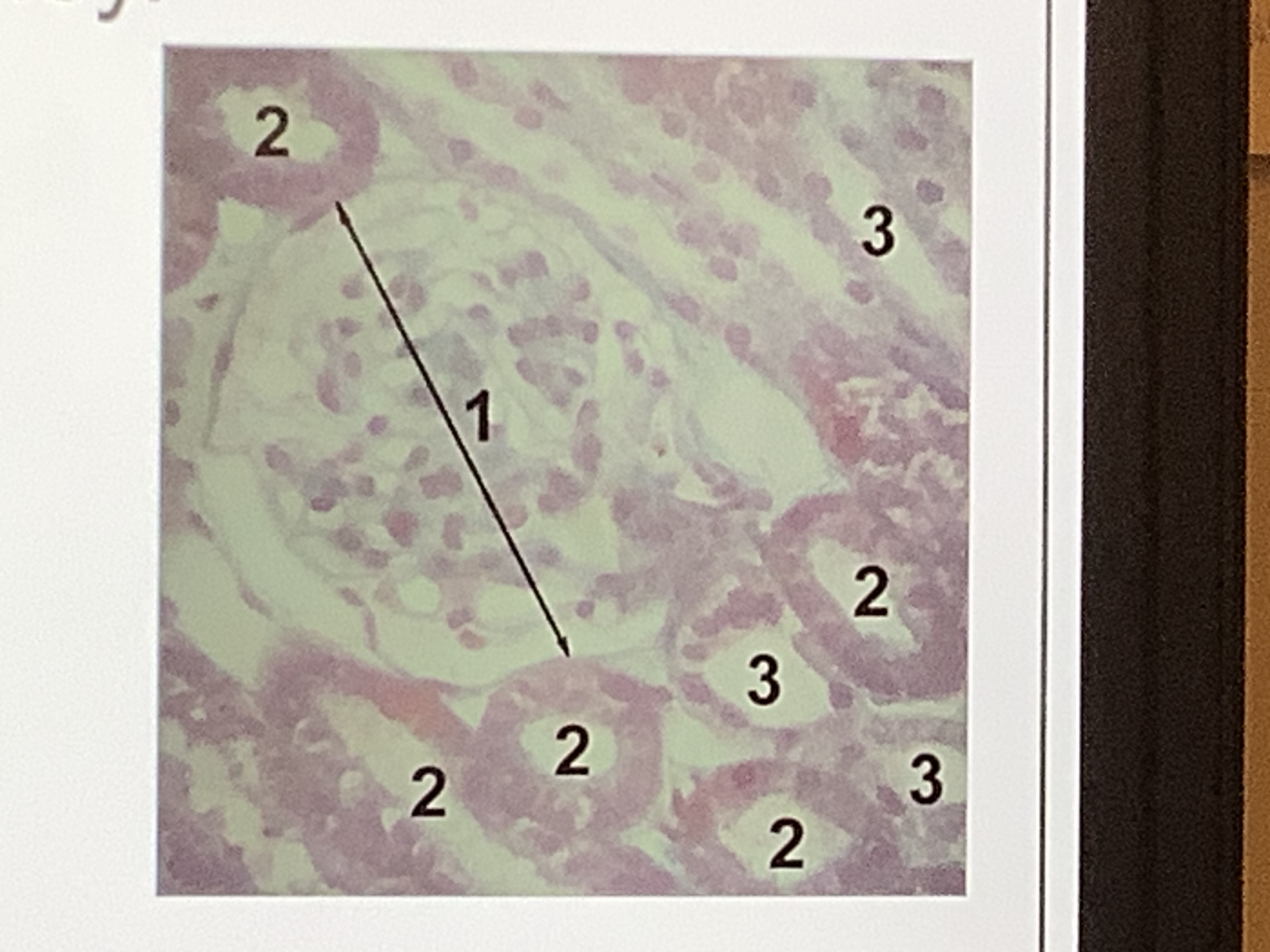 <p>Describe the histology of the kidney using the diagram given</p>