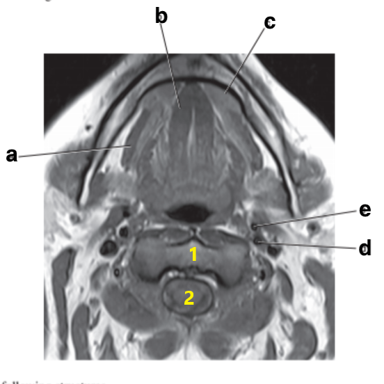 <p>What is letter d?</p>