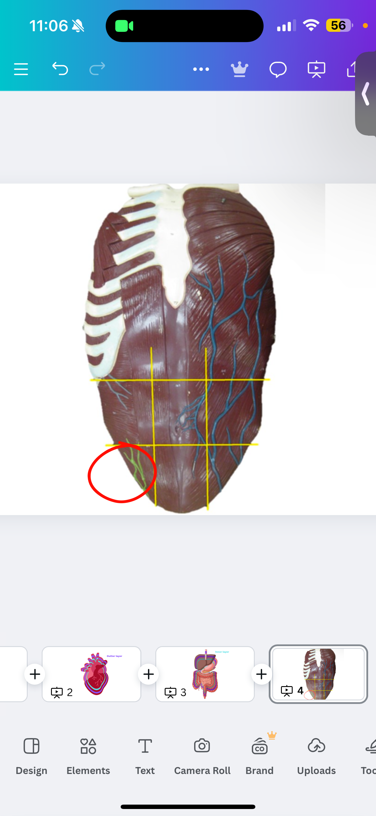 <p>Right inguinal region</p>