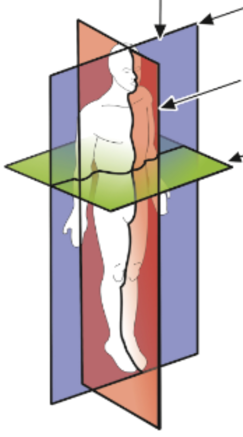 <p>Transverse view =</p>