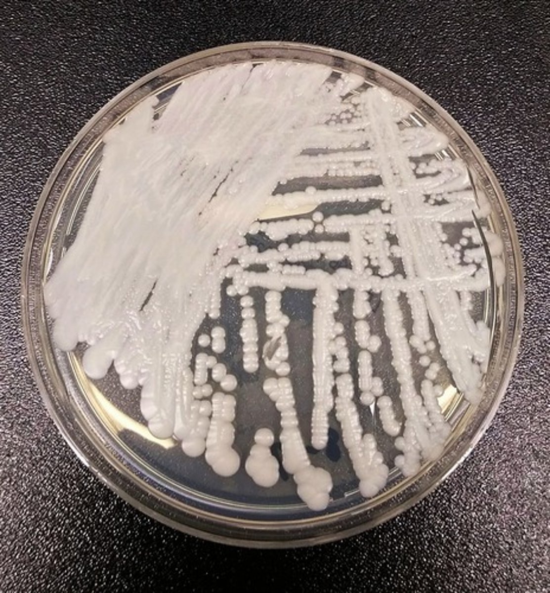 <p>Emerging drug resistant fungal pathogen causing infections in hospitals, affect Central Nervous System (CNS), Due to climate change and selecting fungi that have adapted to grow at human body temperature.</p>