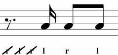 <p>What Variation is This? </p>