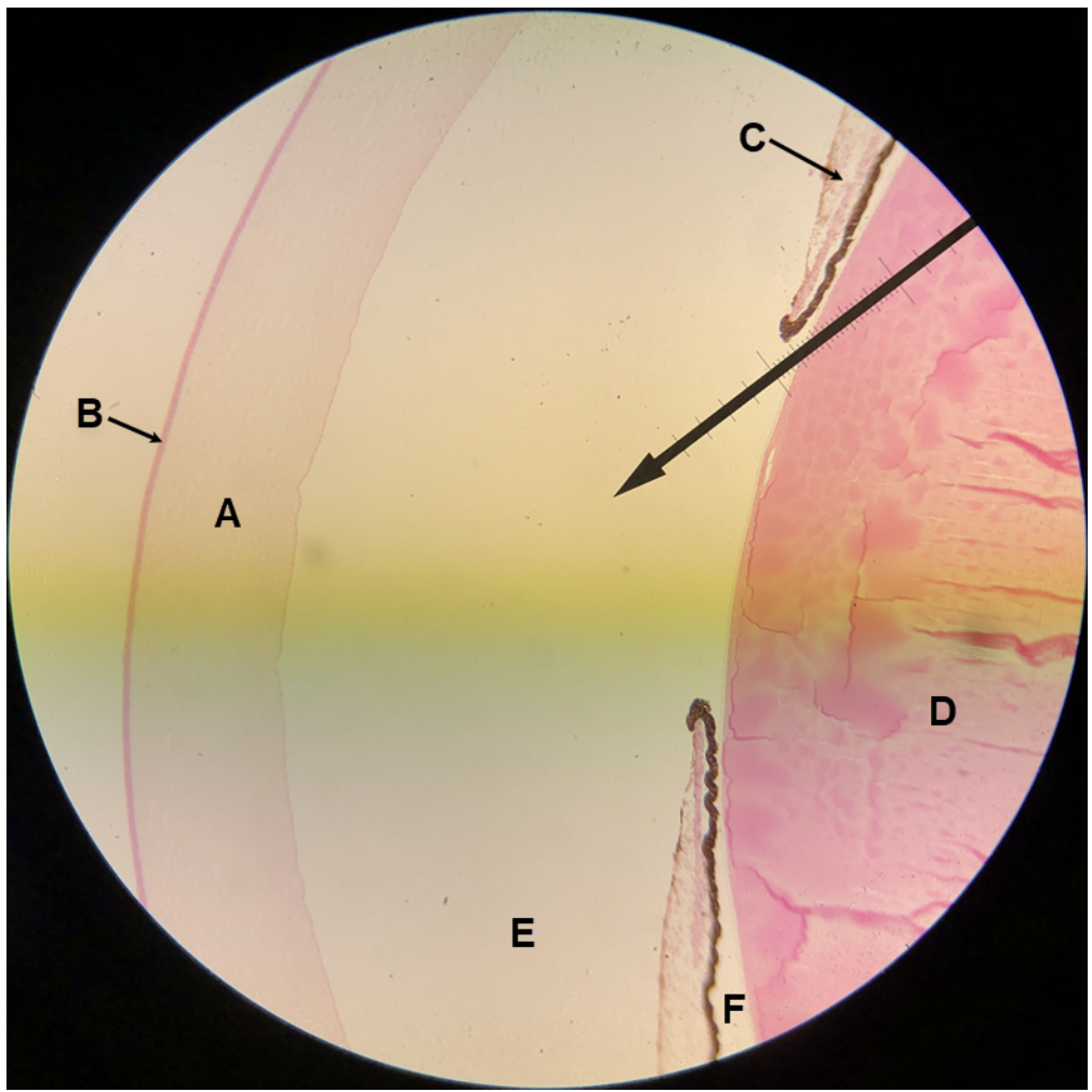 <p><span><span>In the image above, identify structure/part of the eye wall A, structure/tissue B, structures C and D, and spaces E and F. &nbsp;For G, name the space that consists of E and F together.&nbsp;</span></span></p>