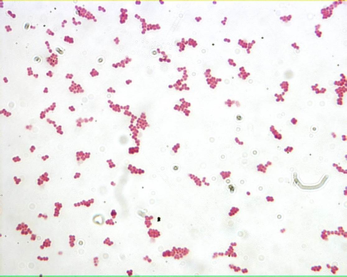 <p>What shape of bacteria is this?</p>