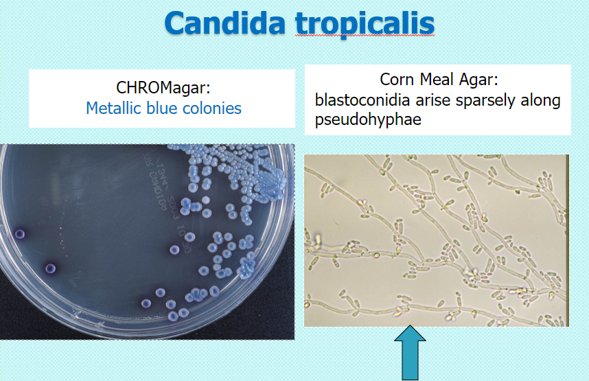 <p>chrom: metallic blue</p><p>CMA: blastoconidia arise sparsely along pseudohyphae (no chlamydospores)</p>