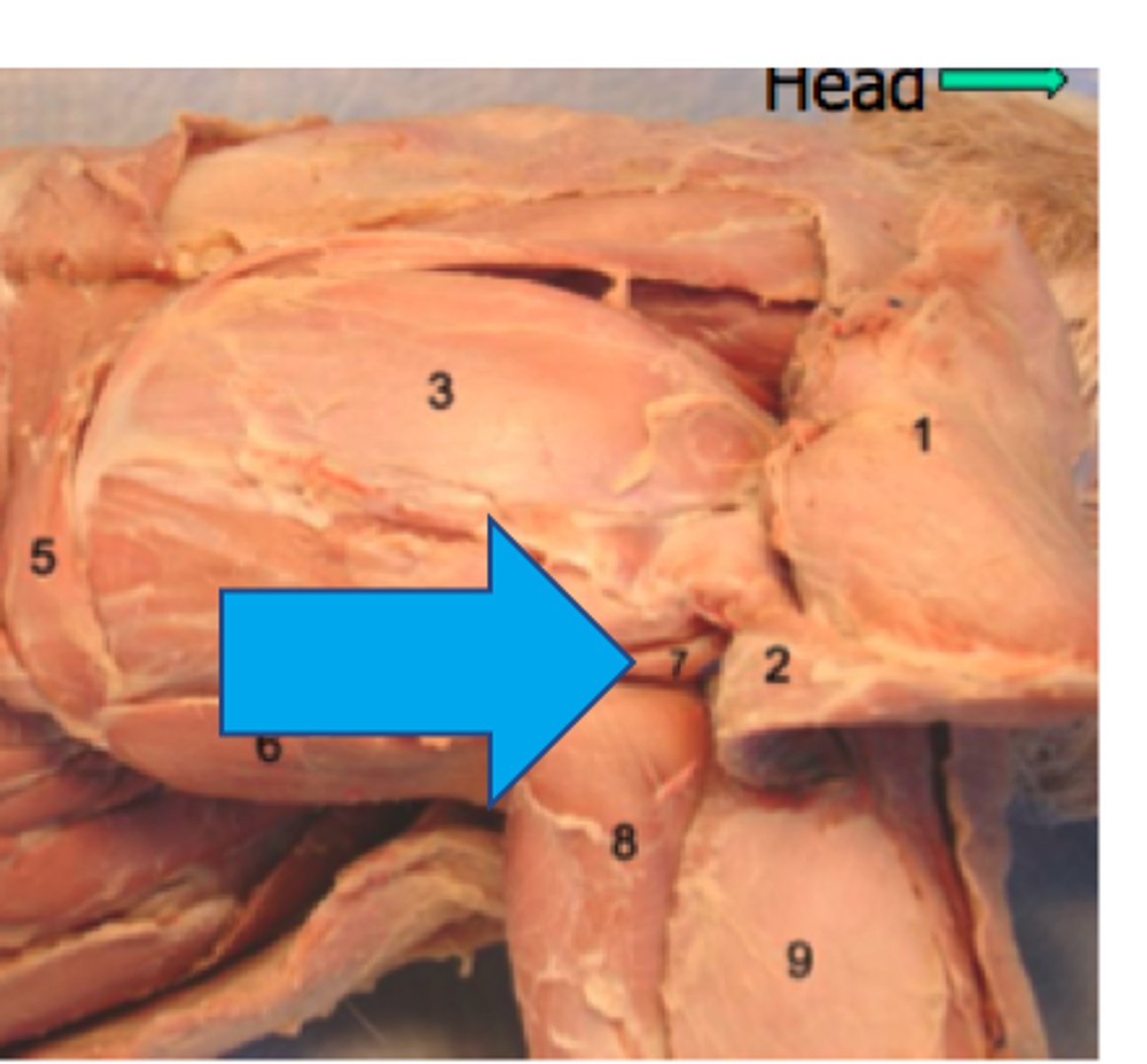 <p>What muscle is this?</p><p>Origin?</p><p>Insertion?</p><p>Action?</p><p>Nerve?</p>