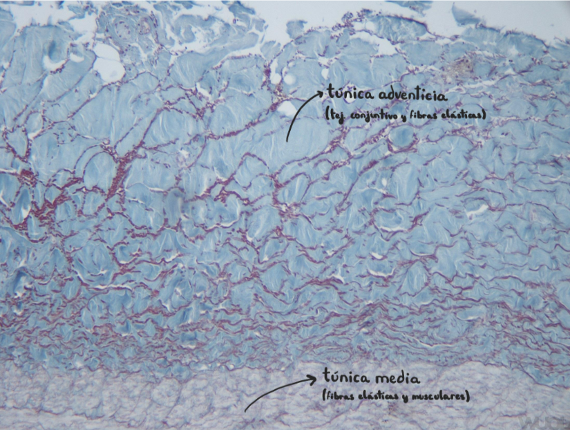 <p>Arteria coronaria (muscular)</p><p>La túnica adventicia en arterias musculares es la más grande</p>
