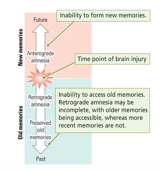 <ul><li><p><span style="color: red"><strong>Anterograde </strong></span>amnesia: No storage of <u>new</u> memories.</p></li><li><p><span style="color: red"><strong>Retrograde</strong> </span>amnesia: Loss of <u>existing</u> memories (may be incomplete).</p></li></ul><p></p>