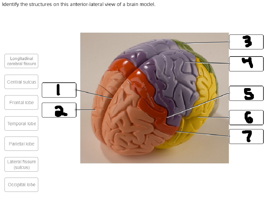 <p>what is labeled #5</p>