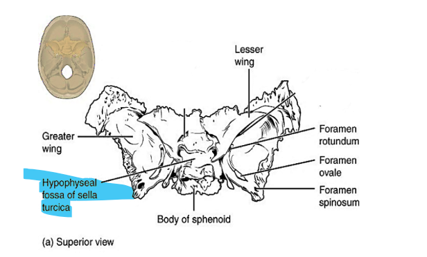 <p>hypophyseal fossa of sella turcica</p>