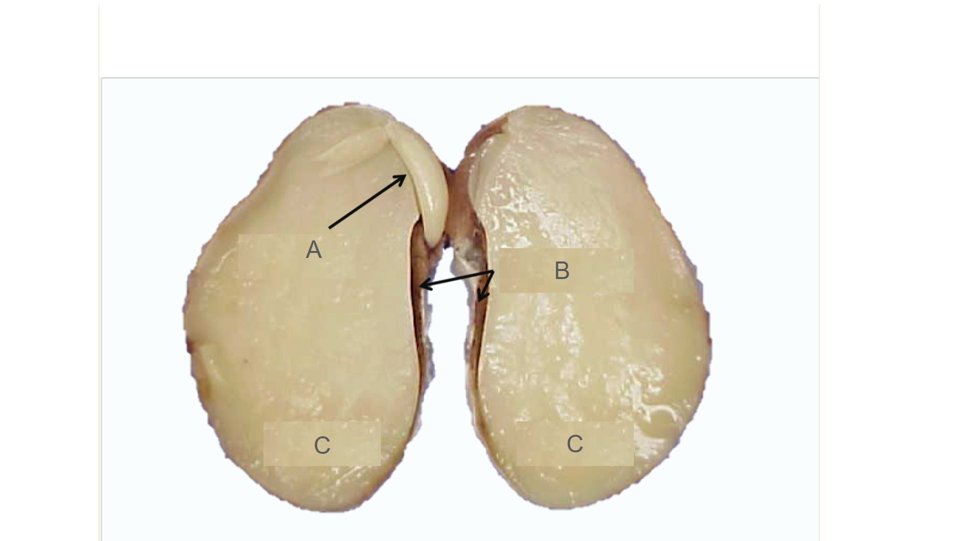 <p>What is A?</p>