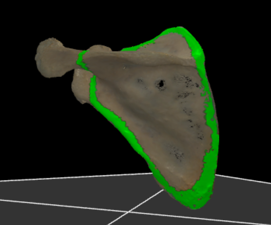 <p>volledige achterzijde van de scapula</p>