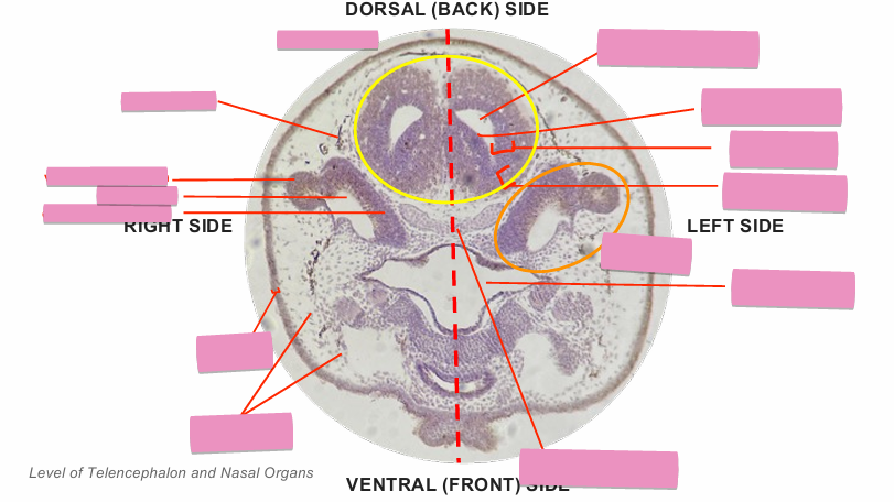 <p>what level<br>primary brain vesicle<br>parts</p>