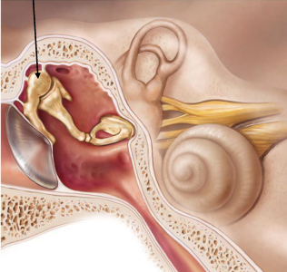 <p>What structure is the malleus secured to?</p>