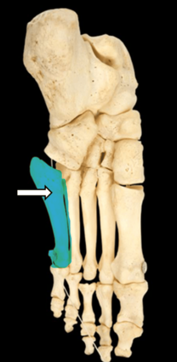 <p>name the part</p>