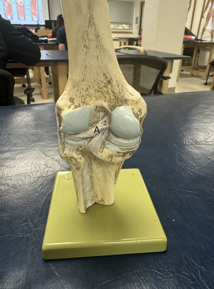 <p>Label this ligament</p>