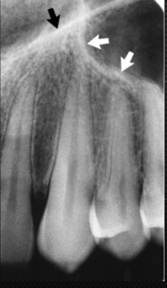 <p>Identify the structures</p>