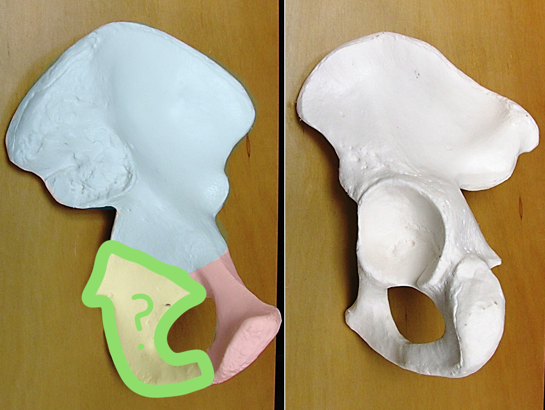 <p>Determine the part of the Coxa highlighted</p>