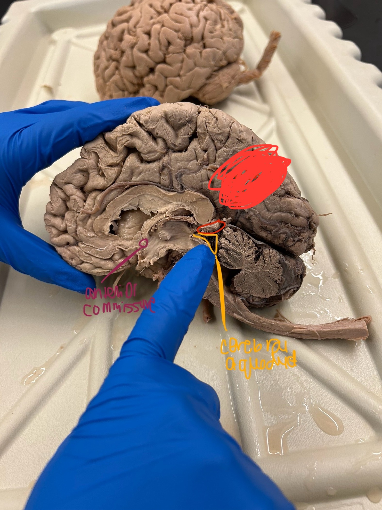 <p>What is this showing?</p>