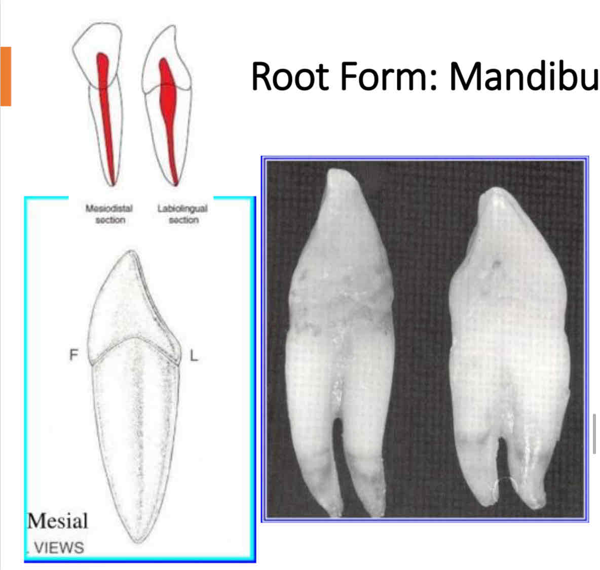 <p>root form of the mandibular canine </p>