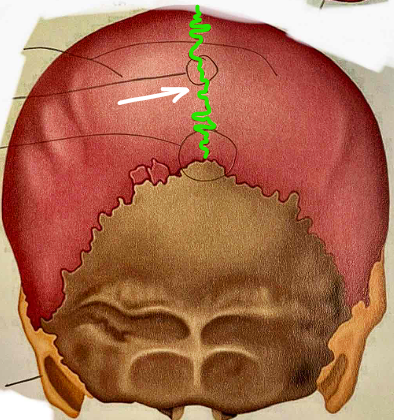 <p>What suture is this?</p>