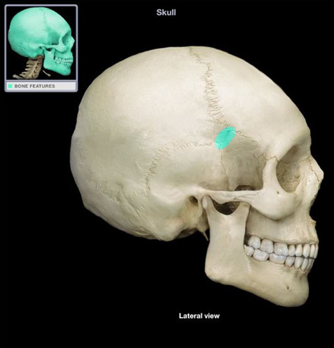 <p>located at pterion (where sphenoid, parietal, temporal, and frontal bones converge)</p>
