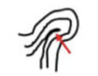 <p>identify ridge characteristic </p>
