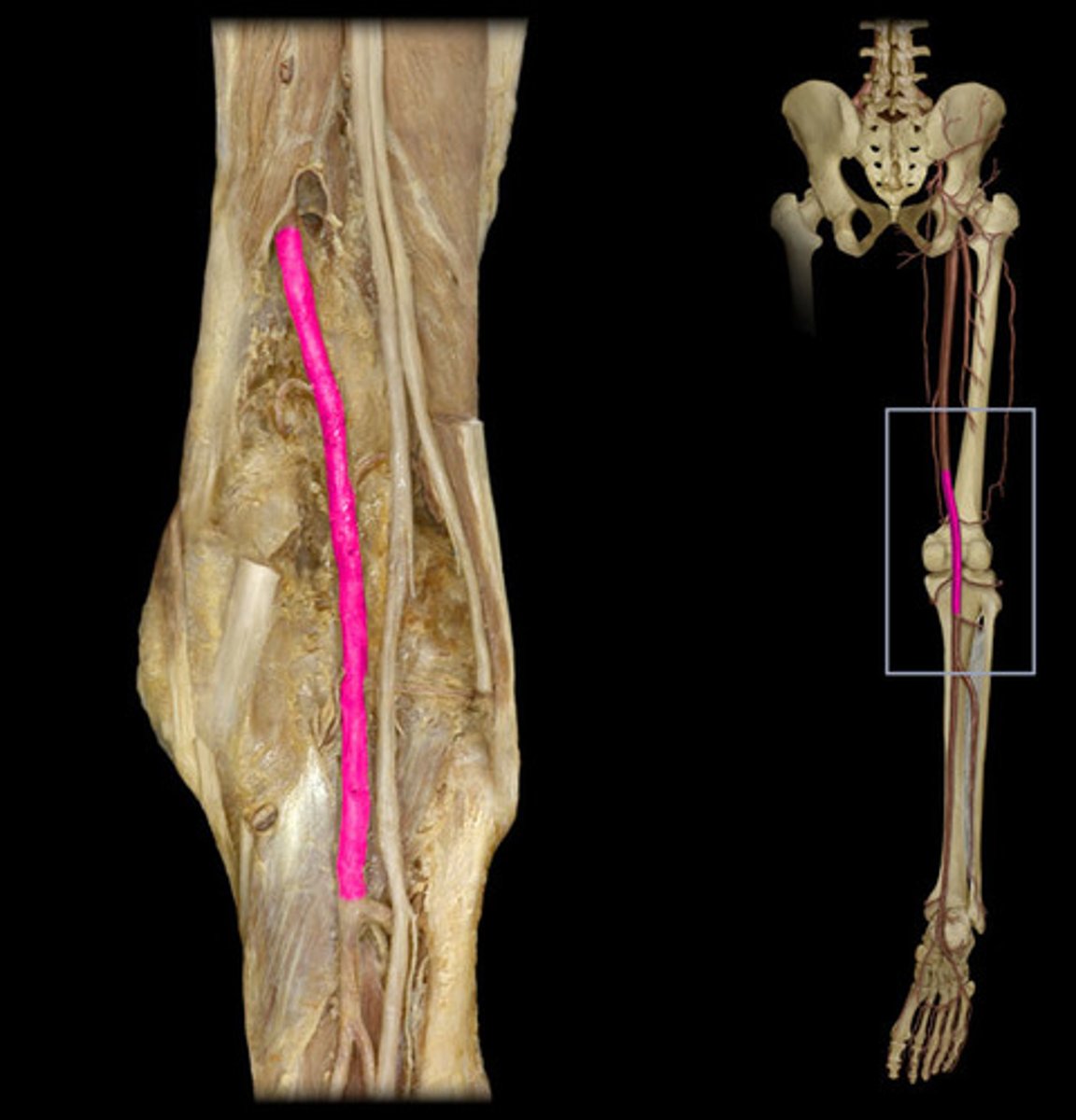 <p>A: Popliteal artery</p>
