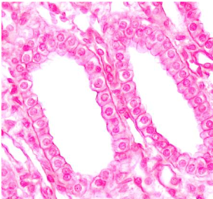 <p>Identify this epithelial tissue, where it is found, and its function.</p>