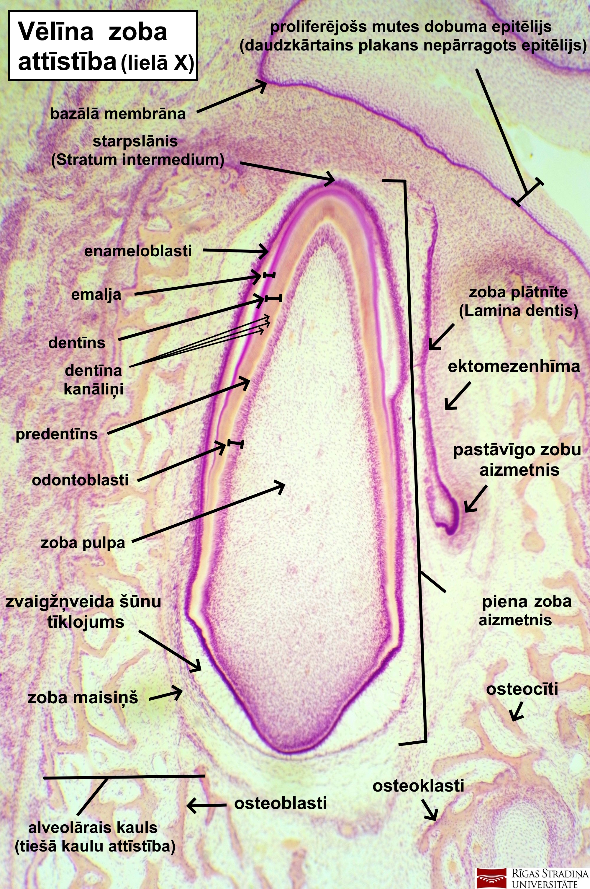 term image