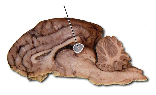 <p>Name the highlighted structure.</p>