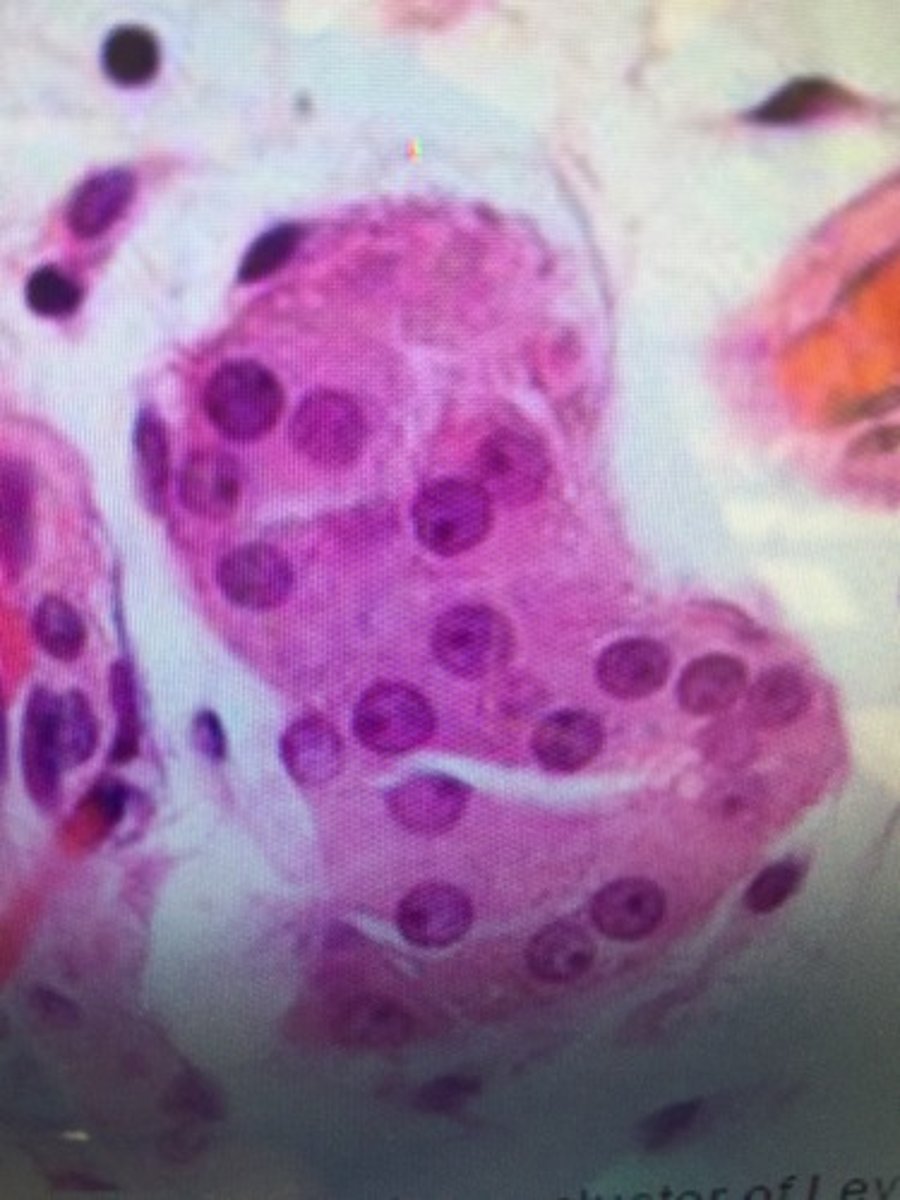 <p>These are found adjacent to the seminiferous tubules in the testicle. They produce testosterone in the presence of luteinizing hormone (LH)</p>