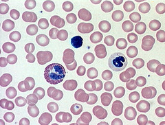 <p>LARGE purple dots are white blood cells Pink are blood cells LITTLE purple ones are platelets</p>