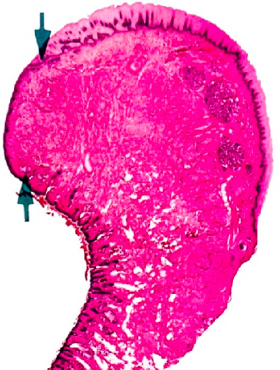 <p><em>identify the mucosa:</em></p>