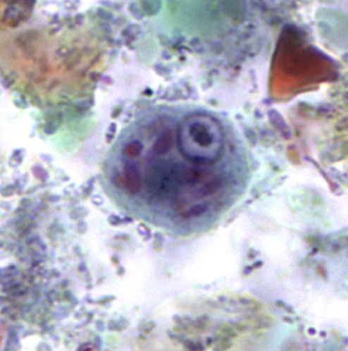 <p>1 nucleus, large glycogen “inclusion mass”, multiple chromatid bodies</p>