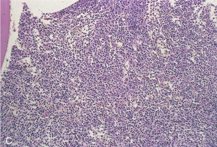 <p>classify the cellularity. include ratio.</p>
