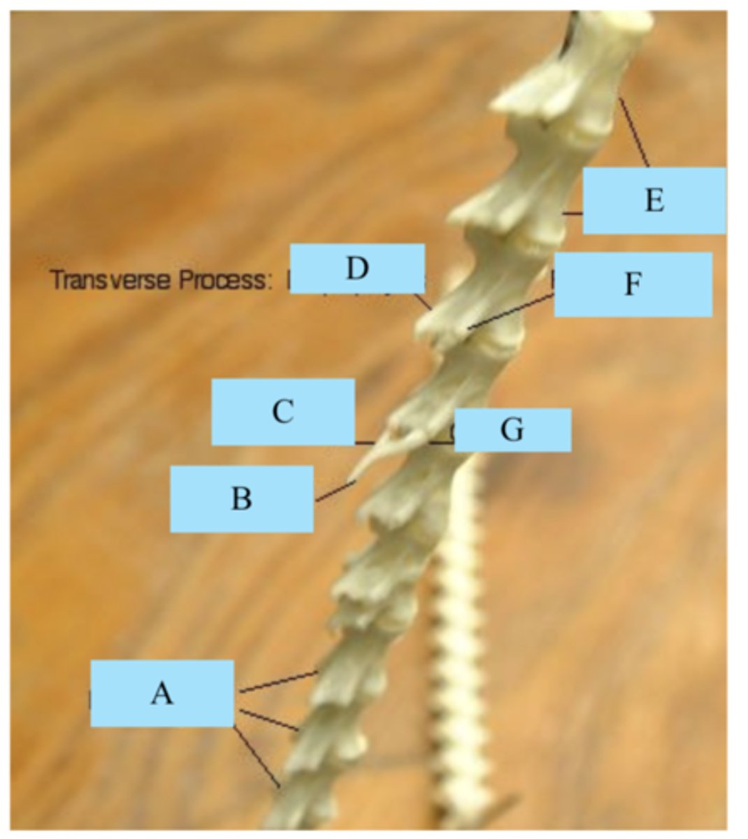 <p>What does letter B point to?</p>