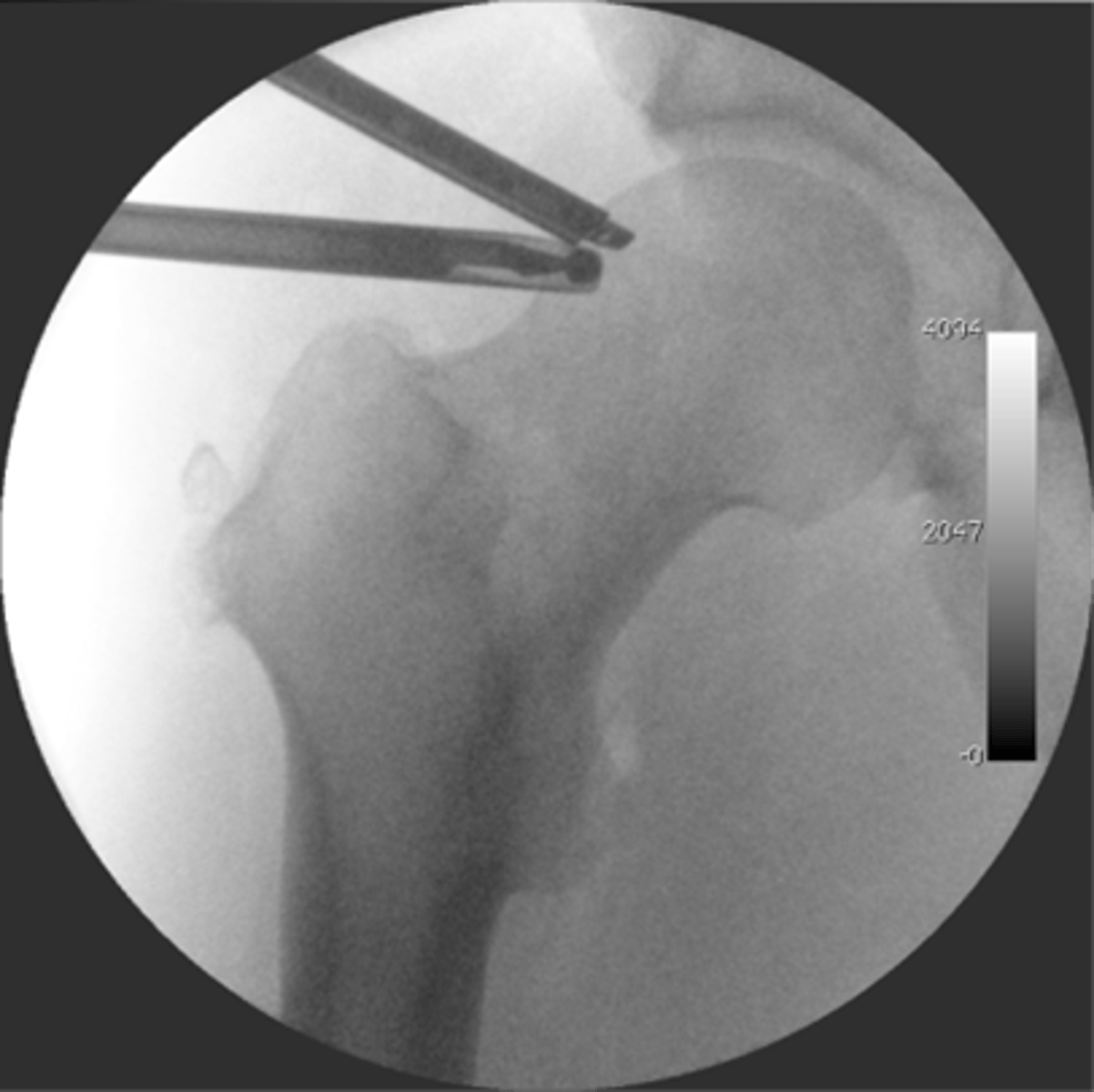 <p>A real time dynamic, continuous, or continuous radiographic exam used to guide interventional procedures</p><p>- Radiograph = Photograph</p><p>- Fluoroscopy = Movie</p>