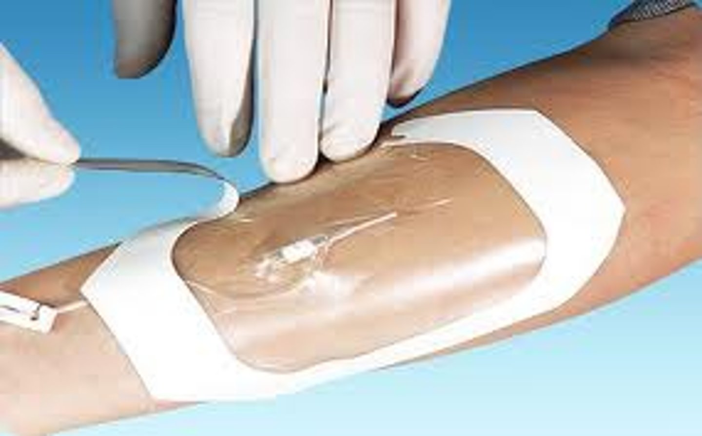 <p>transparent polyurethane membrane, breathes like skin allowing vapor exchange</p>