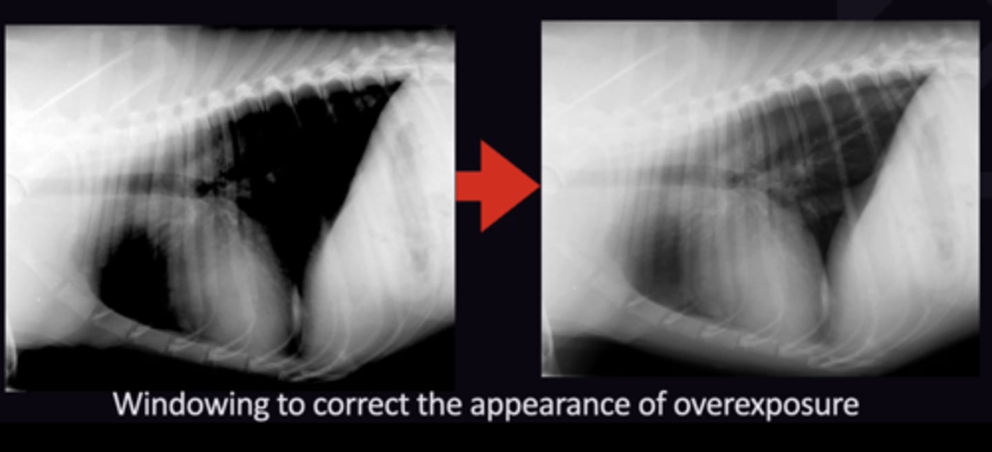 <p>1. Quality of Digital System, can't be changed</p><p>2. Correct Exposure Settings</p><p>3. Post processing to change the density + contrast so the image is the best it can be</p>